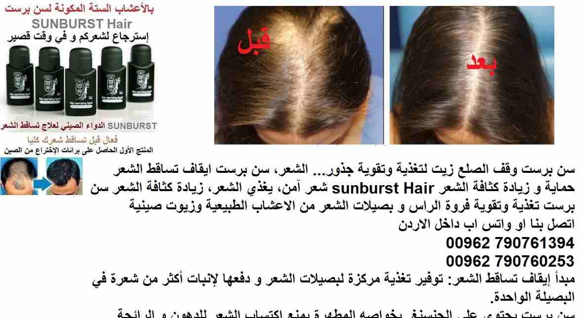 علاج تساقط الشعر | اعادة نمو الشعر؟ سن برست وقف الصلع زيت لتغذية وتقوية جذور( علاج الصلع ) ... الشعر، سن برست ايقاف تساقط الشعر حماية و زيادة كثافة الشعر sunburst Hair شعر آمن، يغذي الشعر، زيادة كثاف...