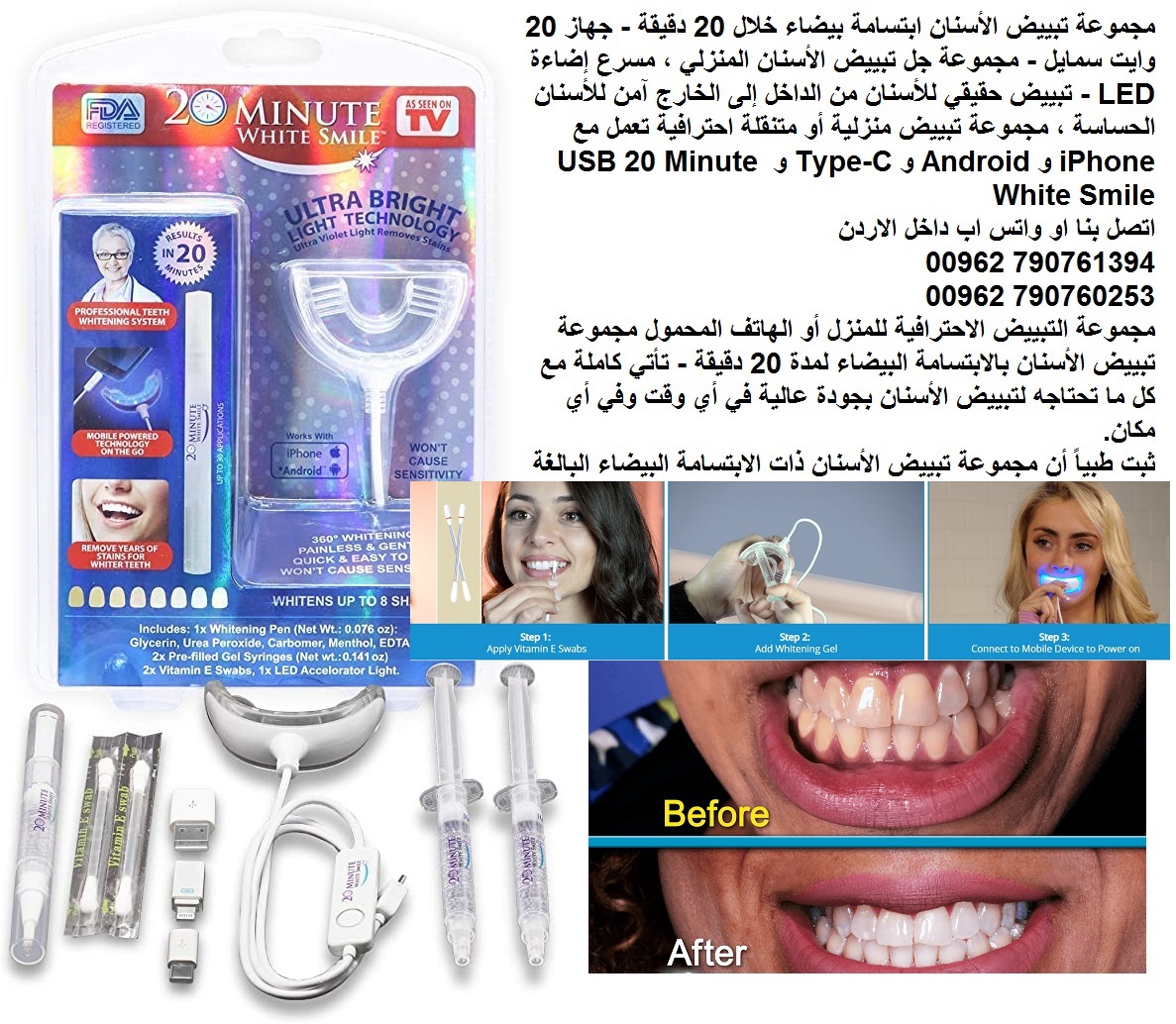 جهاز طبي احصل على ابتسامة هوليود حل سريع لأسنان ناصعة البياض تدوم طويلاً تبييض الأسنان ابتسامة هوليود بيضاء خلال 20 دقيقة - جهاز 20 وايت سمايل - مجموعة جل تبييض الأسنان المنزلي ، مسرع إضاءة LED