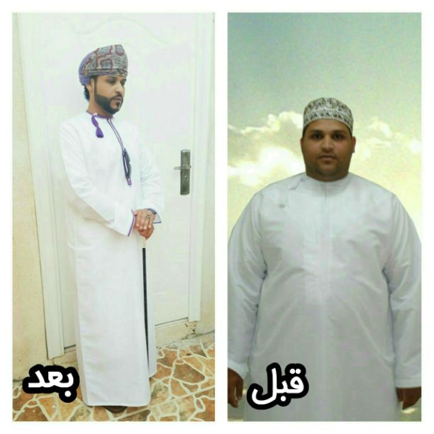 استشاري تغذية علاجية 
تخفيف وزيادة الوزن 
انظمة غذائية مناسبة لمرضي السكرى والضغط والكوليسترول والحامل والمرضع والأطفال 
نزوى فرق بجوار مستشفى بدر السما 
#دكتورمحمدعبدالسلام 
٩٣٦٩٨٣٣٣ 
٩٥٥١٣٧٦٧