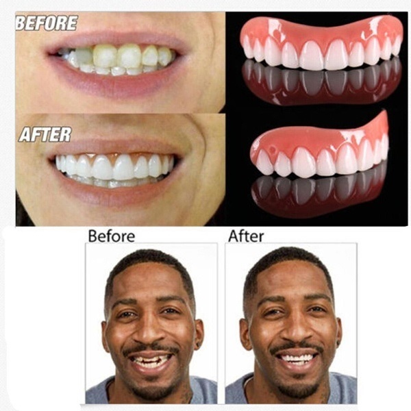 ابتسامة هوليود اسنان علوي مؤقت اكسسوار Perfect Smile اسنان اكسسوار علوية الابتسامة المثالية قشرة و طقم الاسنان