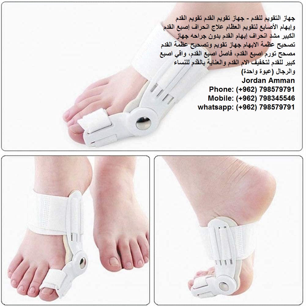 اعوجاج أصبع القدم الكبير طريقة تعديل انحراف إصبع القدم الكبير تصحيح عظمة القدم - جهاز التقويم للقدم