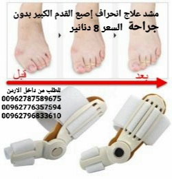 علاج بروز إبهام القدم بدون جراحة جهاز تقويم اصبع القدم الكبير .