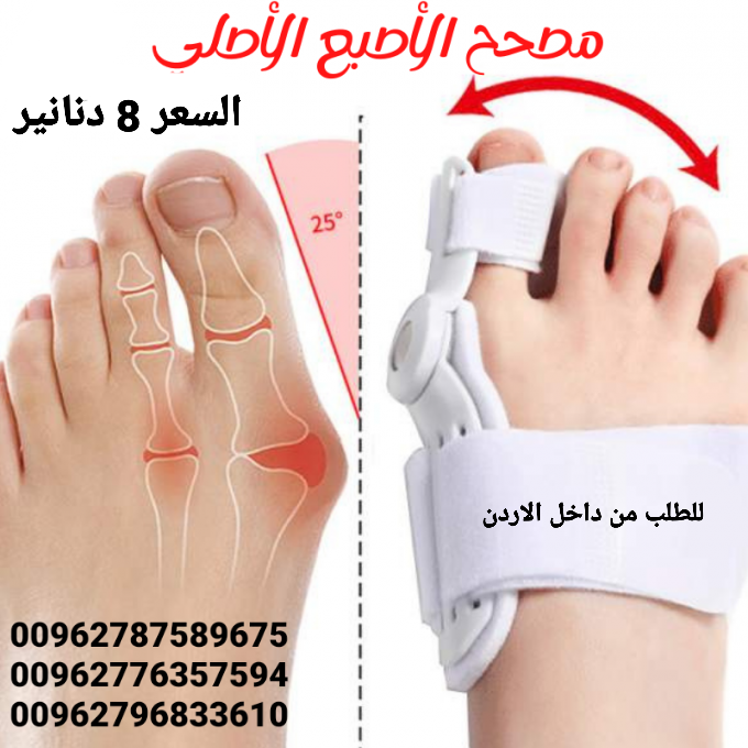 علاج بروز إبهام القدم بدون جراحة جهاز تقويم اصبع القدم الكبير .