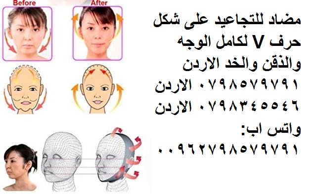 مشد الوجه والذقن اللغلوغ صميم قابل للتهوية, مشدات ضاغطة للرقبة والذقن